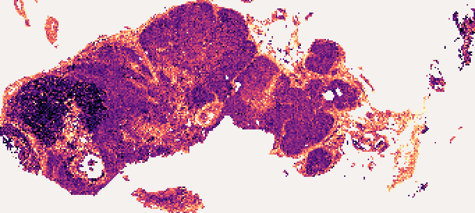 COL1A1 predicted at each of 24,308 tiles of the section, with this sample's own bulk profile: a heat map on the shape of the tissue, brighter where the predicted value is higher. COL1A1 is high in the collagen of the capsule and the septa, which is what a reader checks the map against.