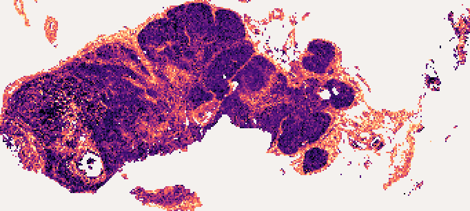 COL1A1 predicted at each of 24,308 tiles of the section, without a bulk profile: a heat map on the shape of the tissue, brighter where the predicted value is higher. COL1A1 is high in the collagen of the capsule and the septa, which is what a reader checks the map against.