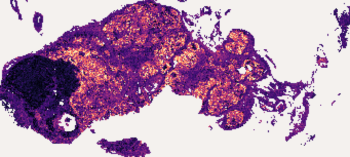 MS4A1 predicted at each of 24,308 tiles of the section, with this sample's own bulk profile: a heat map on the shape of the tissue, brighter where the predicted value is higher. MS4A1 is high in the node's B-cell follicles, which is what a reader checks the map against.