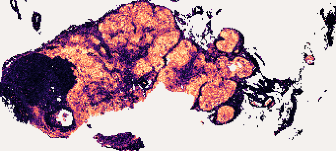 MS4A1 predicted across every retained tissue tile inside that same frame, brighter where the predicted value is higher.