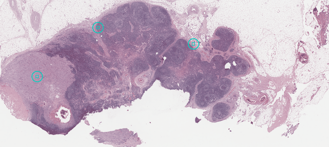 The section at low magnification, pink and purple tissue on a pale mount, with three rings marking the places the worked example shows close up.